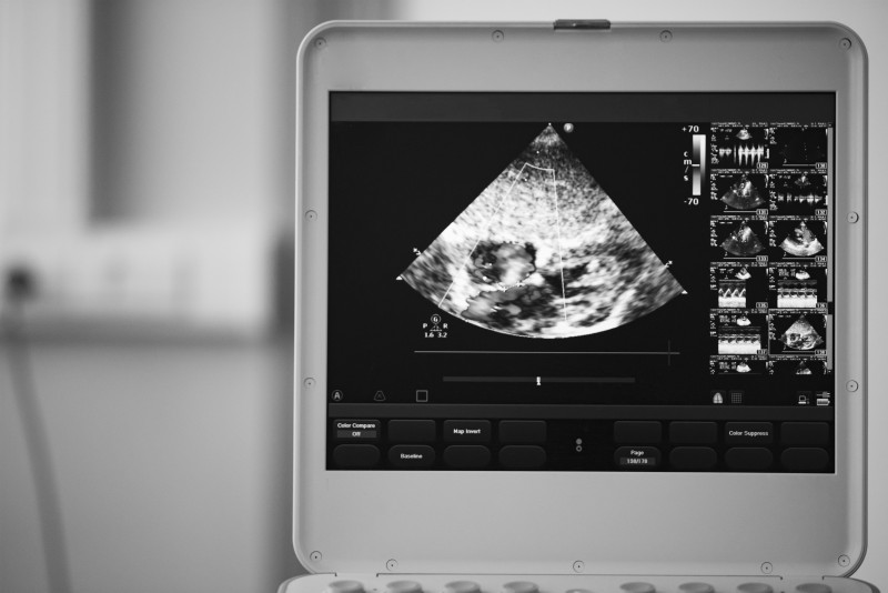 The Benefits You Gain From Buying an Ultrasound Machine for Your Clinic