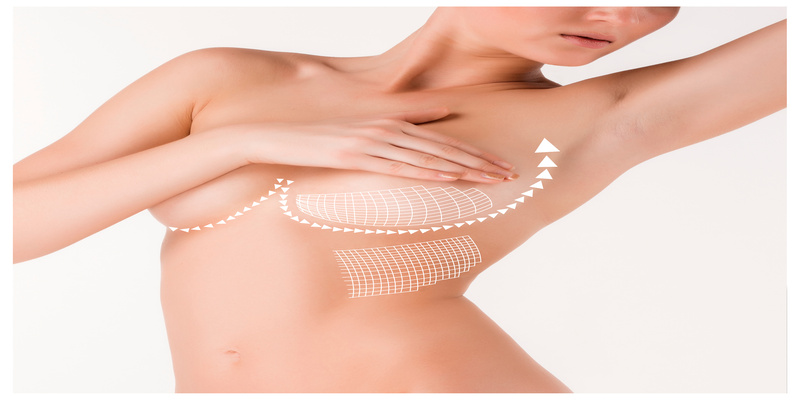 Common Questions About Breast Reduction in Hinsdale